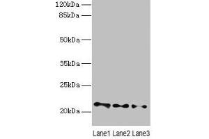 Western blot All lanes: VPS25 antibody at 3 μg/mL Lane 1: Mouse kidney tissue Lane 2: HL60 whole cell lysate Lane 3: THP-1 whole cell lysate Secondary Goat polyclonal to rabbit IgG at 1/10000 dilution Predicted band size: 21 kDa Observed band size: 21 kDa (VPS25 抗体  (AA 1-176))