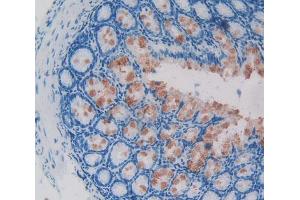 Used in DAB staining on fromalin fixed paraffin- embedded intestine tissue (GLMN 抗体  (AA 294-549))