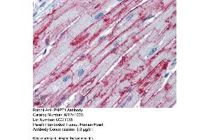 Immunohistochemistry (IHC) image for anti-Polyribonucleotide Nucleotidyltransferase 1 (PNPT1) (Middle Region) antibody (ABIN2776602) (PNPT1 抗体  (Middle Region))