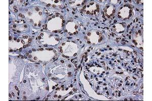 Image no. 5 for anti-CTD (Carboxy-terminal Domain, RNA Polymerase II, Polypeptide A) Small Phosphatase 1 (CTDSP1) antibody (ABIN1497679) (CTDSP1 抗体)