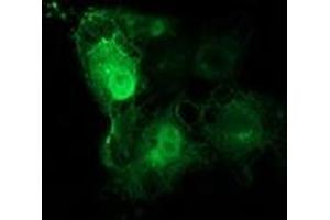 Anti-TUBB4 mouse monoclonal antibody (ABIN2454637) immunofluorescent staining of COS7 cells transiently transfected by pCMV6-ENTRY TUBB4 (RC203945). (TUBB4 抗体)