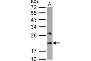 Western Blotting (WB) image for anti-Myosin, Light Chain 6B, Alkali, Smooth Muscle and Non-Muscle (MYL6B) (AA 1-208) antibody (ABIN1499618) (MYL6B 抗体  (AA 1-208))