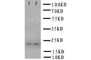 Anti-Prion protein PrP antibody, Western blotting Lane 1: U87 Cell Lysate Lane 2: U87 Cell Lysate (PRNP 抗体  (Middle Region))