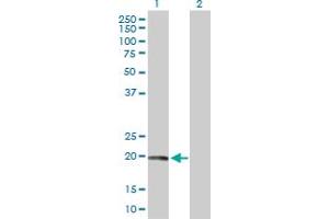 Western Blot analysis of CAV1 expression in transfected 293T cell line by CAV1 MaxPab polyclonal antibody. (Caveolin-1 抗体  (AA 1-178))