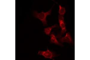 ABIN6267282 staining Hela by IF/ICC. (RAF1 抗体  (pSer338))