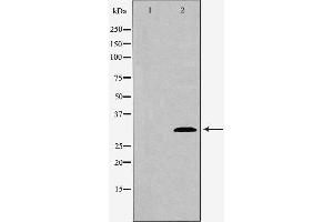 Western blot analysis of extracts of mouse spleen tissue , using ATG5 antibody. (ATG5 抗体  (C-Term))