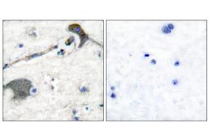 Immunohistochemical analysis of paraffin-embedded human brain tissue, using RASH/RASK/RASN antibody (ABIN5976497). (RASH/RASK/RASN (N-Term) 抗体)
