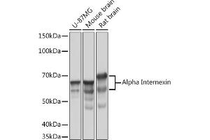 Western blot analysis of extracts of various cell lines, using Alpha Internexin Rabbit mAb (ABIN7268012) at 1:1000 dilution. (INA 抗体)