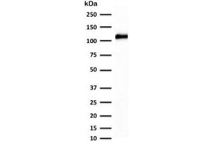 Western blot testing of human kidney lysate with recombinant Cadherin 16 antibody (clone KSCP2-2R). (Cadherin-16 抗体)