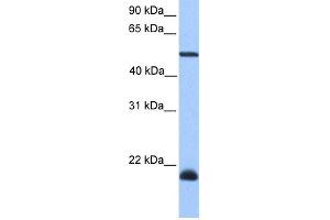 WB Suggested Anti-DYX1C1 Antibody Titration: 0. (DYX1C1 抗体  (C-Term))