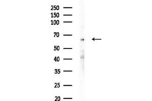 Western blot analysis of lysates from MCF7 cells(heat-shock,45 min treatment), using ARSJ Antibody at 1/1000 dilution.