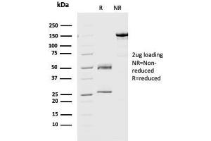 SDS-PAGE Analysis Purified Geminin Monoclonal Antibody (CPTC-GMMN-1). (Geminin 抗体)