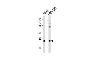 Western blot analysis of lysates from A549,U-87 MG cell line (from left to right),using CATL1 Antibody (heavy chain, Cleaved-Thr288)(ABIN6241621). (CPT1C 抗体  (Cleaved-Thr288))