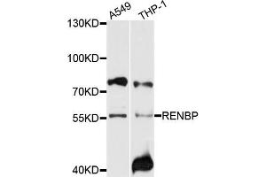 Western blot analysis of extracts of A549 and THP-1 cells, using RENBP antibody.