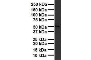 WB Suggested Anti-RARA antibody Titration: 1 ug/mL Sample Type: Human liver (Retinoic Acid Receptor alpha 抗体  (Middle Region))