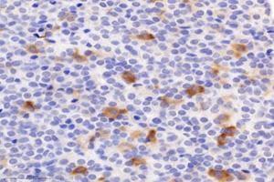 Immunohistochemistry analysis of paraffin-embedded mouse pituitary using,CHST8 (ABIN7073301) at dilution of 1: 3000 (CHST8 抗体)