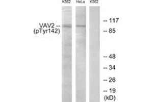 Western Blotting (WB) image for anti-Vav 2 Guanine Nucleotide Exchange Factor (VAV2) (AA 108-157), (pTyr142) antibody (ABIN1531758)