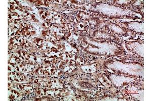 Immunohistochemical analysis of paraffin-embedded human-stomach, antibody was diluted at 1:200 (c-Rel 抗体  (AA 491-540))
