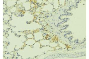 Immunohistochemistry (IHC) image for anti-Endothelin Receptor Type A (EDNRA) (C-Term) antibody (ABIN6257158)