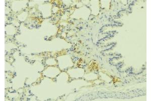 ABIN6275985 at 1/100 staining Human lung tissue by IHC-P. (Endothelin-1 Receptor 抗体  (C-Term))
