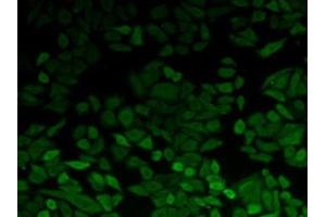 Detection of PGK1 in Hela cells using Polyclonal Antibody to Phosphoglycerate Kinase 1 (PGK1)