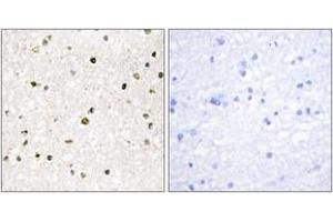 Immunohistochemistry analysis of paraffin-embedded human brain tissue, using AKAP11 Antibody. (AKAP11 抗体  (AA 1761-1810))