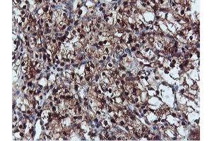 Image no. 5 for anti-Dual Specificity Phosphatase 23 (DUSP23) antibody (ABIN1497930) (DUSP23 抗体)