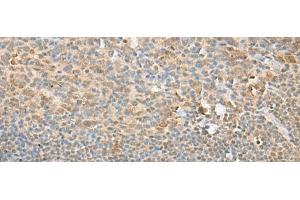 Immunohistochemistry of paraffin-embedded Human tonsil tissue using PSMD12 Polyclonal Antibody at dilution of 1:40(x200) (PSMD12 抗体)