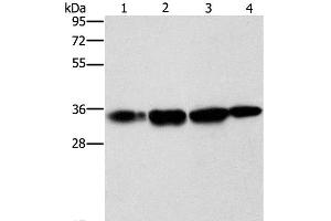 Western Blot analysis of Hela cell and Human prostate tissue, A172 cell and Mouse liver tissue using NSMCE3 Polyclonal Antibody at dilution of 1:1500 (Necdin-Like 2 抗体)