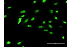 Immunofluorescence of monoclonal antibody to ZIC4 on HeLa cell. (ZIC4 抗体  (AA 1-90))