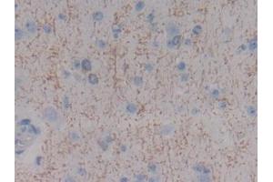 Detection of MBP in Human Cerebrum Tissue using Polyclonal Antibody to Myelin Basic Protein (MBP) (MBP 抗体  (AA 135-190))