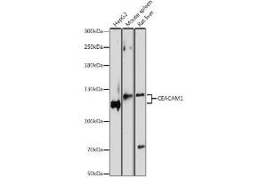Western blot analysis of extracts of various cell lines, using CEACAM1 antibody. (CEACAM1 抗体)