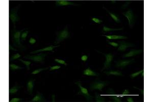Immunofluorescence of monoclonal antibody to LYPLA1 on HeLa cell. (LYPLA1 抗体  (AA 66-151))