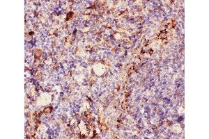 IHC-P: MAC-1 antibody testing of mouse spleen tissue (Integrin beta 2 抗体  (AA 17-382))