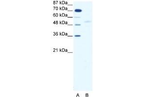 WB Suggested Anti-SMAD5 Antibody   Titration: 2. (SMAD5 抗体  (Middle Region))