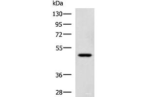 Western blot analysis of TM4 cell lysate using SNIP1 Polyclonal Antibody at dilution of 1:1150 (SNIP1 抗体)