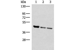 Western blot analysis of Human fetal liver tissue PC-3 and A172 cell lysates using SCCPDH Polyclonal Antibody at dilution of 1:1000 (SCCPDH 抗体)