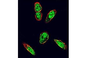 Immunofluorescence (IF) image for anti-Proto-oncogene tyrosine-protein kinase Src (Src) (AA 1-30), (N-Term) antibody (ABIN392107)