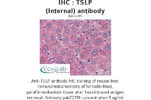 Image no. 1 for anti-Thymic Stromal Lymphopoietin (TSLP) (Internal Region) antibody (ABIN1740423) (Thymic Stromal Lymphopoietin 抗体  (Internal Region))