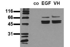 Western Blotting (WB) image for anti-SHC (Src Homology 2 Domain Containing) Transforming Protein 1 (SHC1) (pTyr239), (pTyr240) antibody (ABIN126888) (SHC1 抗体  (pTyr239, pTyr240))