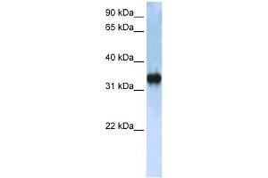 ZCCHC17 antibody used at 1 ug/ml to detect target protein. (ZCCHC17 抗体  (C-Term))