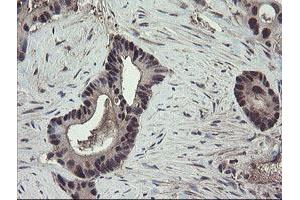Image no. 6 for anti-TSC22 Domain Family, Member 1 (TSC22D1) antibody (ABIN1501535)