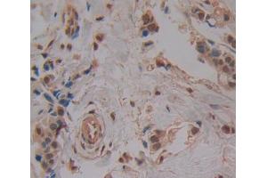 Used in DAB staining on fromalin fixed paraffin- embedded breast cancer tissue (DTYMK 抗体  (AA 43-190))