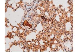 Immunohistochemistry (IHC) image for anti-Forkhead Box O4 (FOXO4) (pThr451) antibody (ABIN6256565)