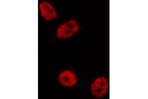 ABIN6268870 staining A-431 cells by IF/ICC.
