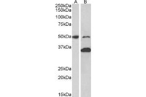 ABIN2563878 (1µg/ml) staining of Mouse fetal (A) and adult (B) Brain lysates (35µg protein in RIPA buffer). (MKRN1 抗体  (AA 105-118))