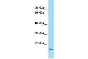 Host: Rabbit Target Name: DEF8 Sample Type: Fetal Kidney lysates Antibody Dilution: 1. (DEF8 抗体  (N-Term))
