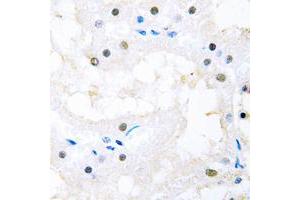 Immunohistochemical analysis of FOXC1/2 staining in human kidney formalin fixed paraffin embedded tissue section. (FOXC1 抗体  (Center))