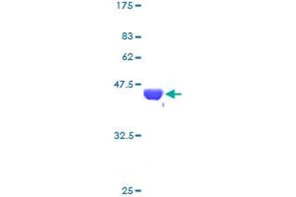 NME2 Protein (AA 1-152) (GST tag)
