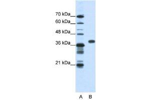 WB Suggested Anti-PCBP1  Antibody Titration: 1. (PCBP1 抗体  (Middle Region))